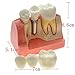 Enshey Dental Implant Analysis Dental Demonstration Teeth Model Crown Bridge Demonstration Teeth 2017