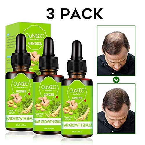 Hair Growth Oil, Hair Care Product, Hair Serum, Fast Hair Growth, Hair Growth & Hair Thickening,Stop Hair Loss, Grow Hair Fast, Hair Loss Treatment for Men & Women