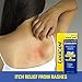 Lanacane Maximum Strength Anti-Itch Cream, 1 oz, 2in1 Fast Acting Itch Relief and Kills Germs (Pack of 3)