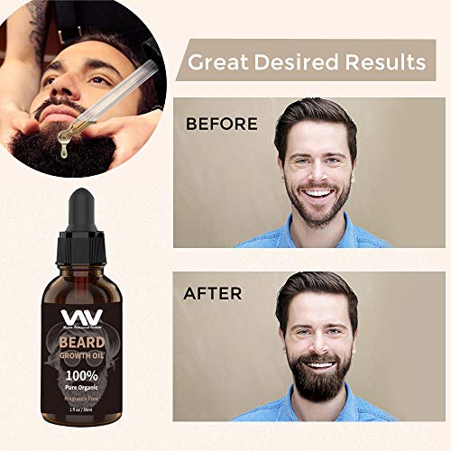 Beard Growth Kit, Derma Roller + Beard Growth Oil Serum + Beard Balm + Comb for Men, Facial Hair Growth Kit, Titanium Microneedle Beard Roller Kit, Best Value Beard Care Kit for Men