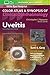 Uveitis (Color Atlas and Synopsis of Clinical Ophthalmology)