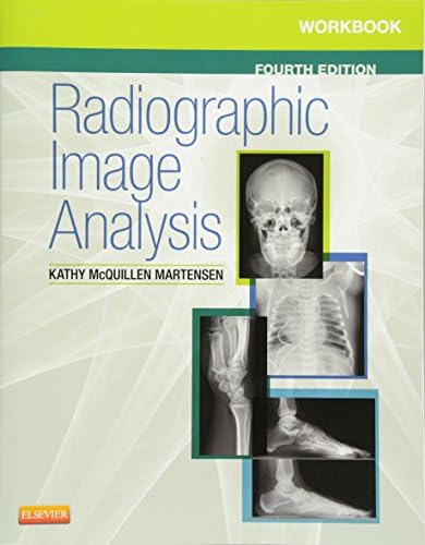 Amazon.com: Learning Radiology: Recognizing the Basics