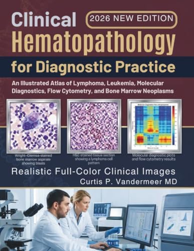 Soft Tissue and Bone Tumours: WHO Classification of Tumours
