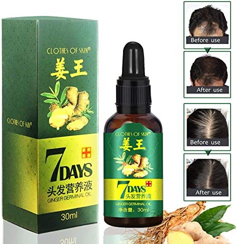 Hair Growth Serum, Hair Care Product, Hair Serum, Fast Hair Growth, Hair Growth & Hair Thickening,Stop Hair Loss, Grow Hair Fast, Hair Loss Treatment for Men & Women(30ml) (30ml)