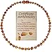 Mommy's Touch 100% Natural Amber Teething Necklace (Cognac) - Anti-Inflammatory & Teething Pain Reducing Properties Unisex Necklace With Twist-in Screw Clasp