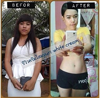 Beauty Set : Double Set Whitening Body Set,Yuri White lotion+Yuri White cream+Yuri White Soap [Free Facial Hair Epicare Spring A1Remover]K348