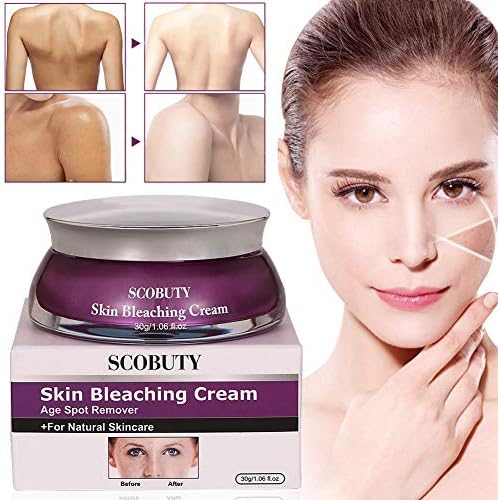 bleaching cream to remove dark spots