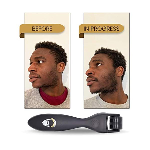 KING-LEONIDAS-03mm-Titanium-Derma-Roller-for-Beard-Growth-Microneedle-Roller-also-for-Fine-Lines-Enlarged-Pores-Skin-Discolouration-Increased-CreamSerum-Absorption-Includes-Travel-Case KING LEONIDAS Derma Roller | 0.3MM Titanium Needles | Beard Roller for Hair and Beard Growth | Derma Roller Hair Growth…
