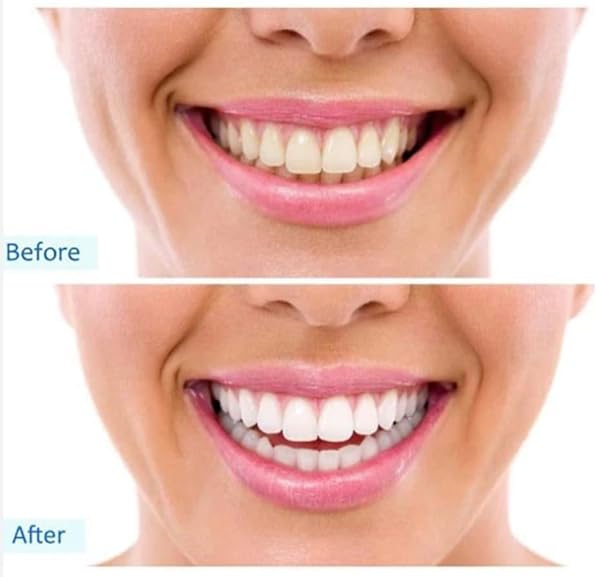 PEPSODENT TP COMPLETE CAR SIZE 5.5Z PEPSODENT COMPLETE CARE TOOTHPASTE 5.5Z