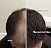 Samson Hair Fibers for Thinning Hair - 100% Undetectable Natural Formula - Completely Conceals Hair Loss in Seconds. Covers bald spots. Thicken your hair instantly - 25 Grams Refill (DARK BROWN)