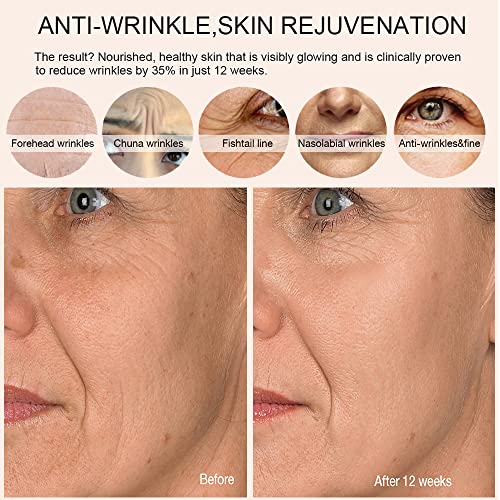 FDA Cleared LED Face Mask Light Therapy, NEWKEY Red Blue Light Therapy