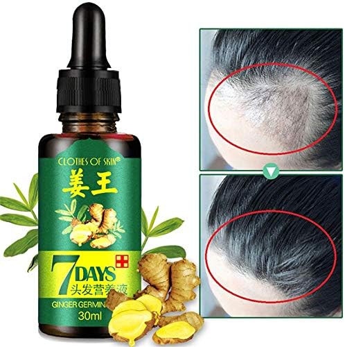 Rivadal Chinese Herbal Formula Prevent Hair Growth Hair Solid Hair Nutrition Hair Nutrition Liquid for Bald Postpartum, 30ml