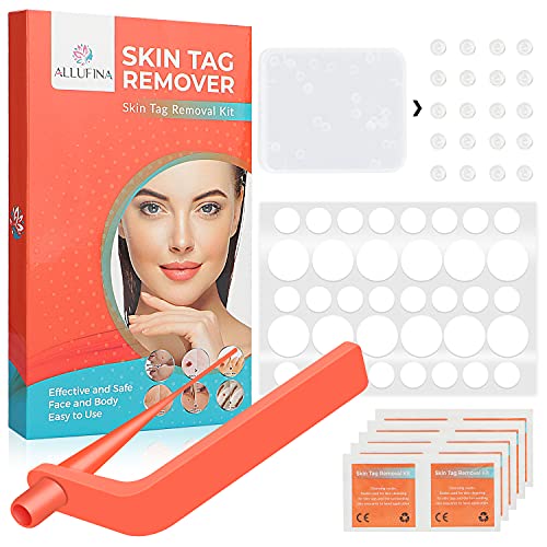 Painless Safe Skin Tag Remover Device Kit Micro