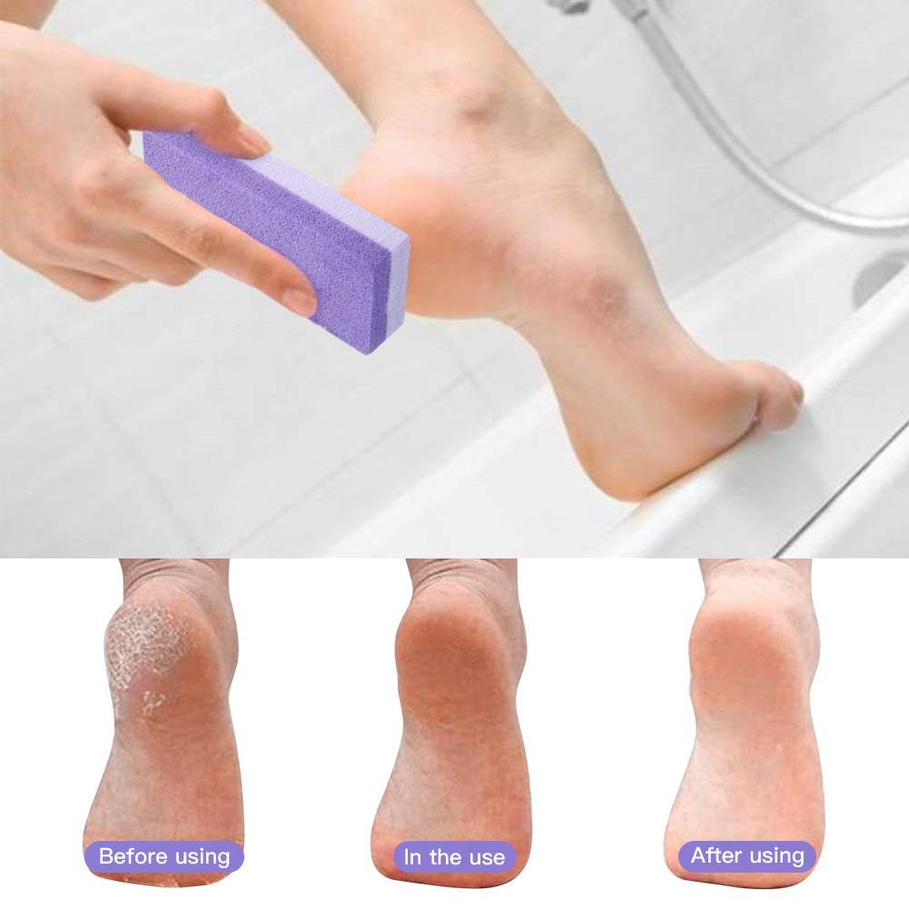 Pumice Stone for Feet (Pack of 4), Chialstar 2 in 1 Callus Remover and Pumice Pad, Pedicure Stone Scrubber for Smooth Feet, Hands and Body, Exfoliation Tool to Remove Dead Skin: Beauty