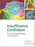 Image de Insuffisance cardiaque. : De la physiopathologie au traitement