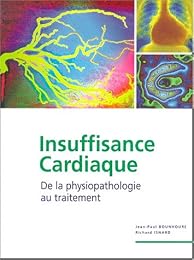 Insuffisance cardiaque