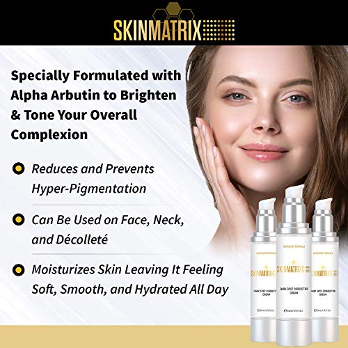 Dark Spot Corrector Skin Brightening Cream Naturally Fades Spots and
