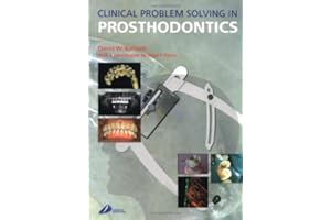 Clinical Problem Solving in Prosthodontics