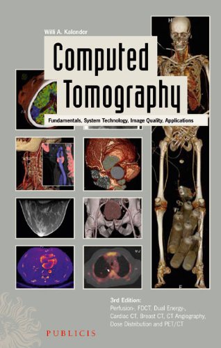 Computed Tomography 3e - Fundamentals, System Technology, Image Quality, Applications