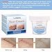 Scar Cream, Scar Treatment, Stretch Mark Cream, Scar Removal Cream, Acne Spots Treatment, Scar Cream for Face & Body, Old & New Scars from Cuts, C-Sections & Surgeries (35g)