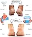 Moisturizing Socks, Heel Socks, PlanMoisturizing Socks, Heel Socks, Plantar Fasciitis Silicone Sleeve,New Material,Gel Socks for Dry Cracked feet, Reduce Pressure on Heel,Relief Heel Pain and Cracked Heel.(3 Pairs)