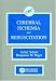 Cerebral Ischemia and Resuscitation by Avital Schurr, Benjamin M. Rigor
