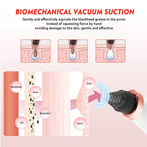Aspirateur Point Noirs, liaboe Nettoyant de Pores Rechargeable Appareil de Beauté du Visage Avec écran LED, 5 Sondes et 3 Modes, 4 Sondes kit Éliminer les Acnés Comédons