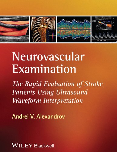 Neurovascular Examination: The Rapid Evaluation of Stroke Patients Using Ultrasound Waveform Interpretation