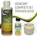 Acne Zap Drying Lotion - Overnight Acne Spot Treatment Dries Out Blemishes, Zits, Whiteheads, Pimples and Blackheads - Extra Strength Natural Solution for Acne Prone Skin - 1 fl oz