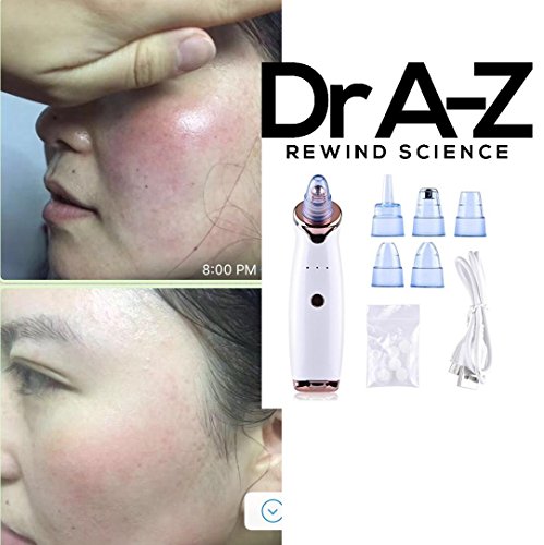 Blackhead Remover, Pore Vacuum Electric Pimple Vacuum Extractor Clean Tool - Comedo Pore Extractor Beauty Device Whitehead Pore Cleaner Suction Cleanser Microdermabrasion Blackhead sucker