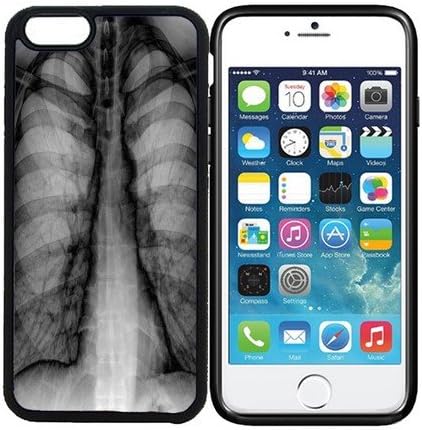 iPhone 6 (4.7 inch display) Designer Black Case - Chest X Ray Radiology