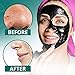 Blackhead Remover Mask - Face Mask Deep Cleansing - Charcoal Peel Off Mask for Face, Nose - Black Mask for All Skin Types