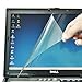 CaseBuy® 15.6-Inch Anti-Glare & Anti-Fingerprint & Anti-Scratch Matte Finishing Non-Touch Screen Guard Protector for Dell Inspiron 15 3000 5000 15-3521 15-3531 15-3541 15-3542 15-3542 15-5521 15-5547 series (NOT Fit TouchScreen Laptop) - Retail Packaging