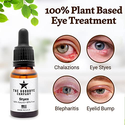 Stye Eye Treatment, Chalazion Remover And Blepharitis Treatment Made In The USA (30 ML) on