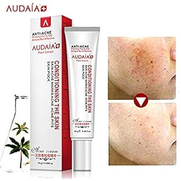 bleaching cream for acne scars