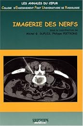 Imagerie des nerfs