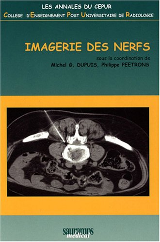 Imagerie des nerfs