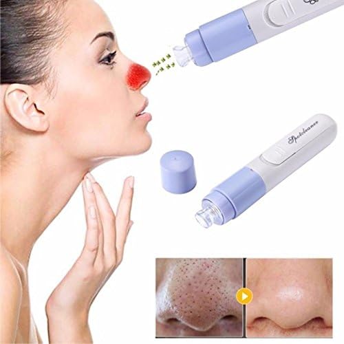 Vacuum Suction Handheld Electric Skin Care Facial Blackhead Removal Cleaner without Battery Inside (15 x 3 x 3 cm, White)