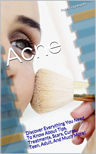 Download Acne: Discover Everything You Need To Know About Tips, Treatments, Scars, Cures, Teen, Adult, And Much More!