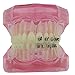 Dentalmall 1 Pc Dental Orthodontics Study Model with Ceramic and Metal Brackets 3003