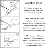Dentaplex Disposable Skin Stapler with Remover 35 Preloaded Staples Surgical view 3