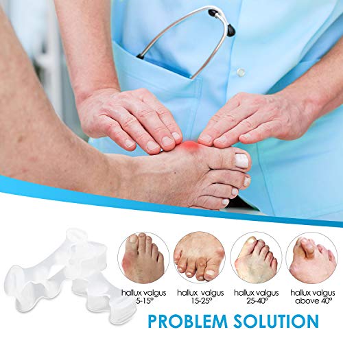 ALSTEN Anatomical Toe Separators,Correct Your Toes Naturally | Great for Pedicure, Bunion Corrector & Yoga(2 Pack)
