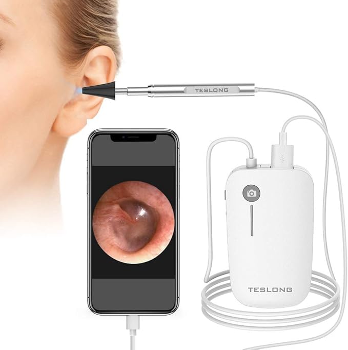 Teslong Otoscopio iPhone, cámara de inspección HD de 0.169 in, microscopio de oído