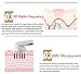 YAVOCOS Facial Mesotherapy Electroporation RF Radio Frequency LED Photon Device Face Lifting Tighten Wrinkle Removal Skin Care Massager