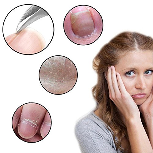 6 RTYou+Clippers+Toenails+Professional+Podiatrist