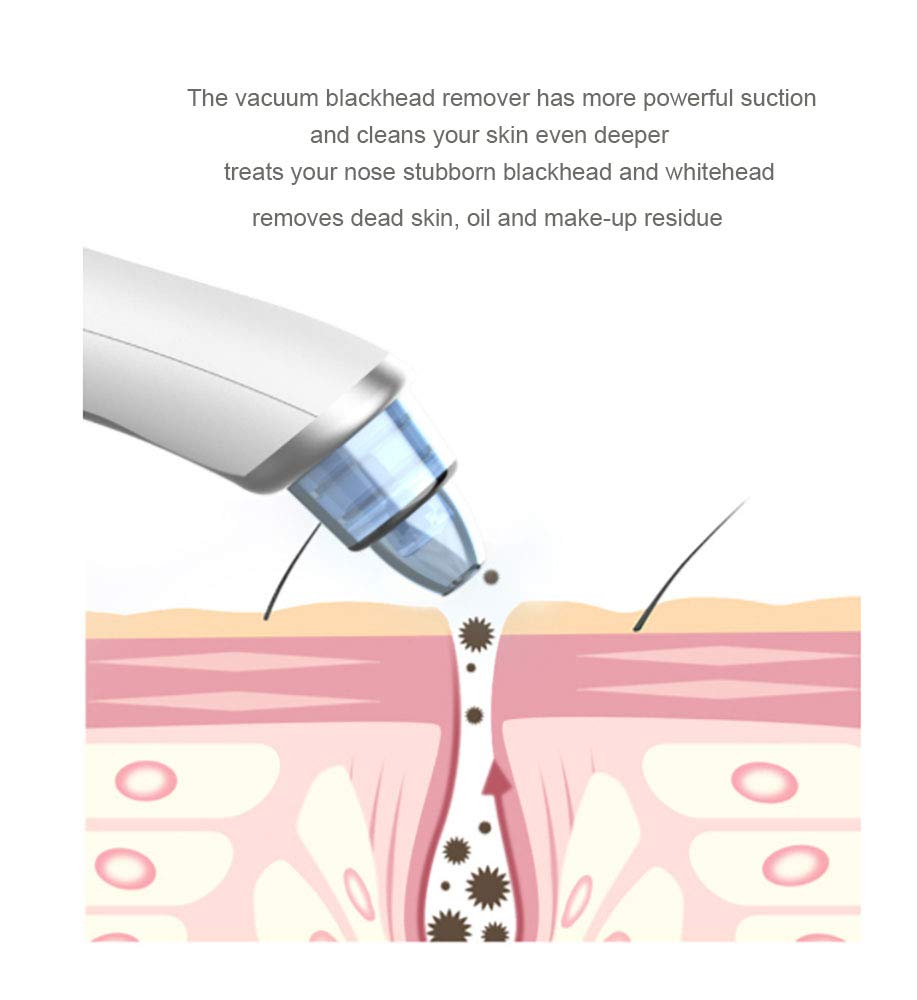 Blackhead Remover Vacuum Pore Cleaner, Wisfun Facial Pore Blackhead Extractor Tool Acne Comedo Removal Suction Beauty Device with 3 Adjustable Suction and 4 Replacement Probes