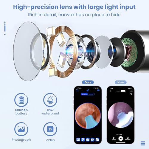Ear Wax Removal, Ear Cleaner with 8 Pcs Ear Set, Ear Wax Removal Kit, 1296P HD Endoscope with 6 LED Lights, Kids Adults Ear Cleaning Gift, Compatible with iPhone & Android Smart Phones