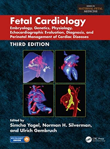 Amazon.com: Echocardiographic Anatomy in the Fetus eBook : Chiappa