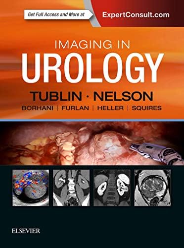 Hinman's Atlas of Urologic Surgery Revised Reprint: 8600007167991