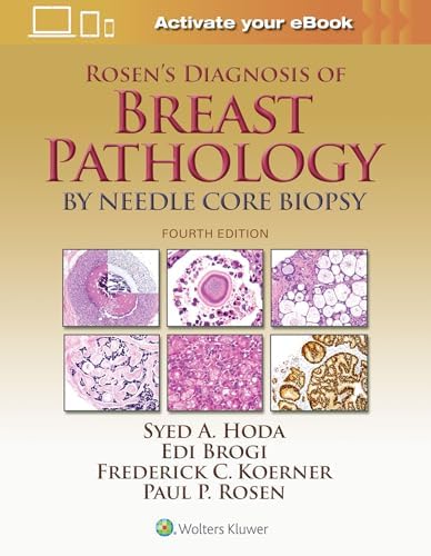 Rosen's Diagnosis of Breast Pathology by Needle Core Biopsy